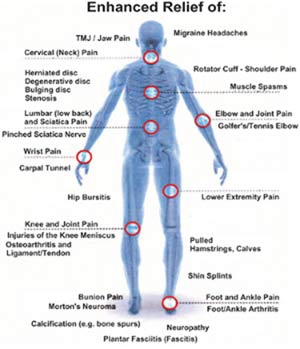 Laser Therapy Conditions Relief Chart